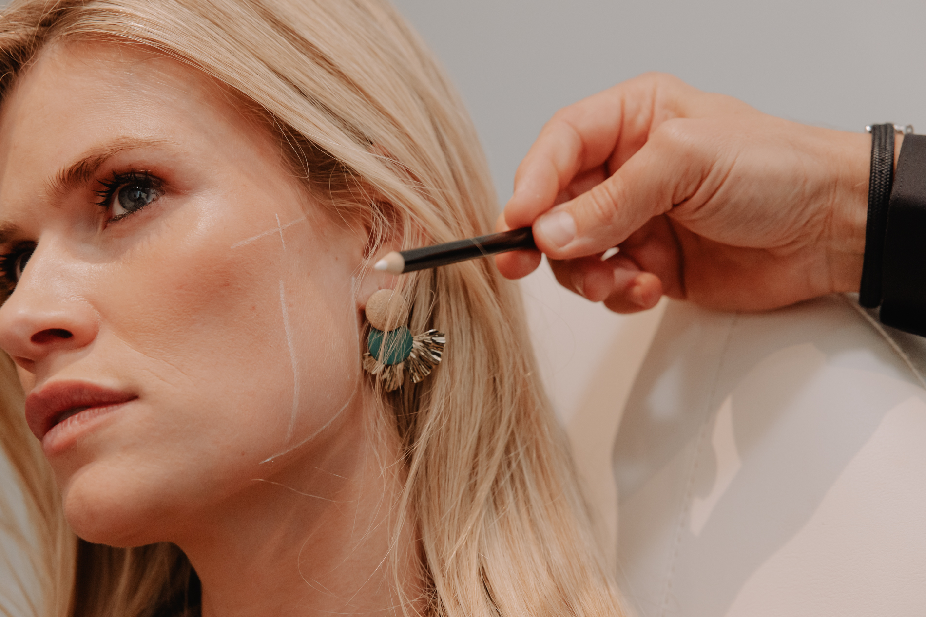 Behandeling gezicht verslanken met botox bij Skinject Clinic in Waasmunster