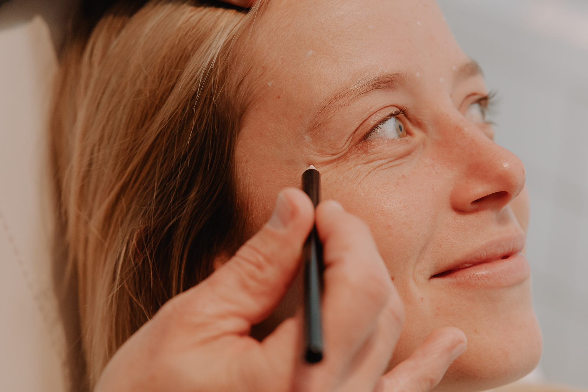 Botulinetoxine – ontspanning van de oogspier