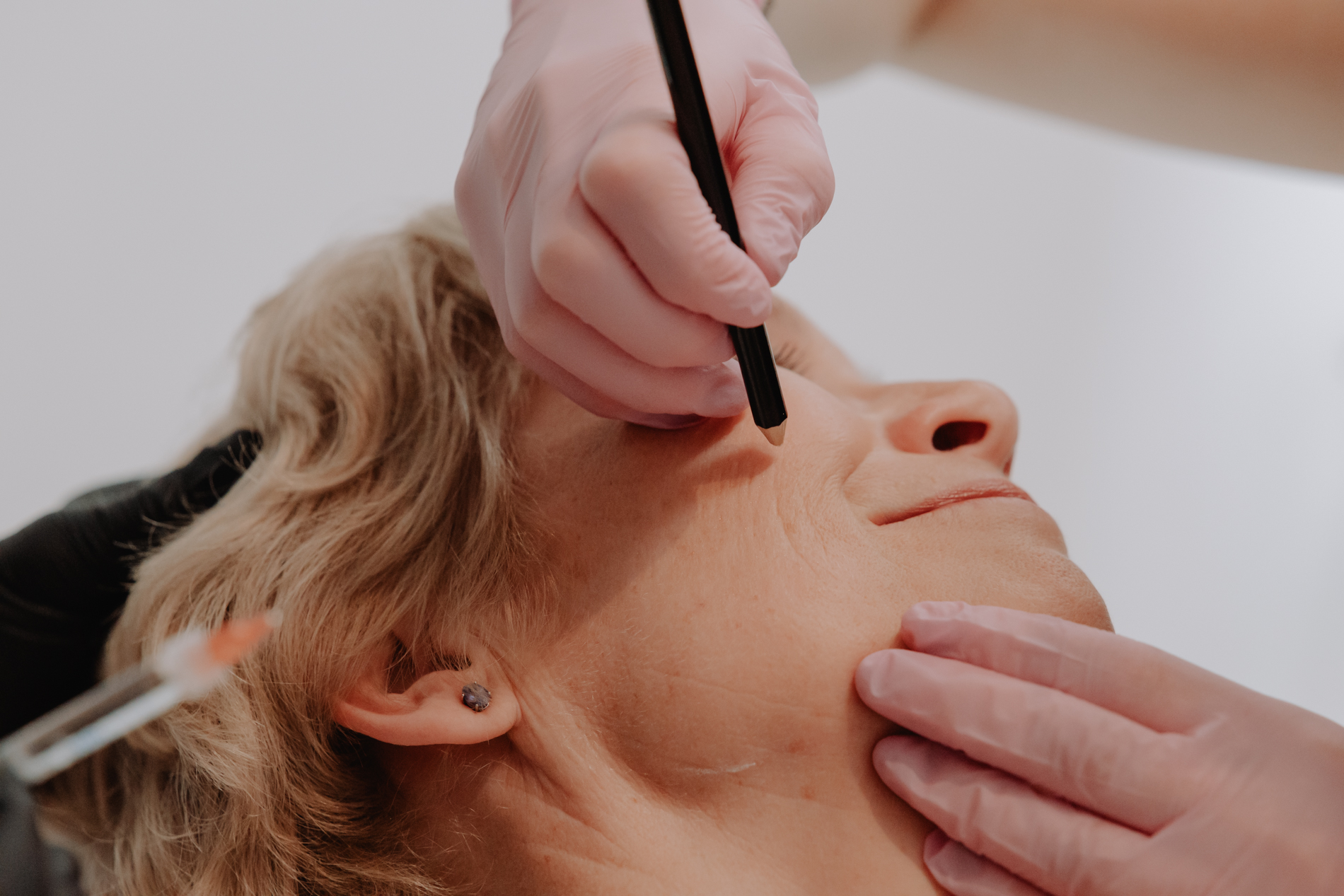 Fijne lijntjes op de wangen