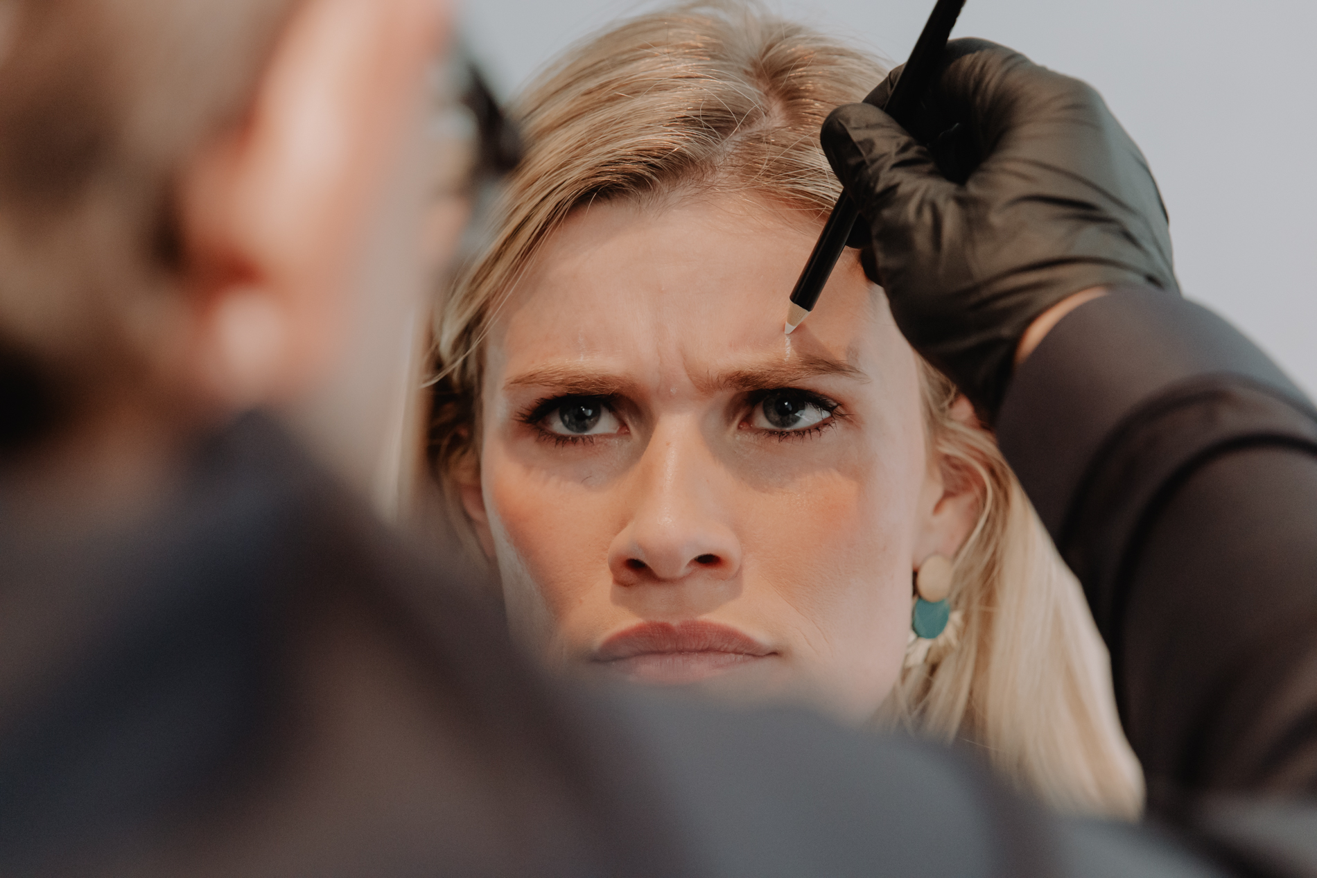 Behandeling frons met botox bij Skinject Clinic in Waasmunster