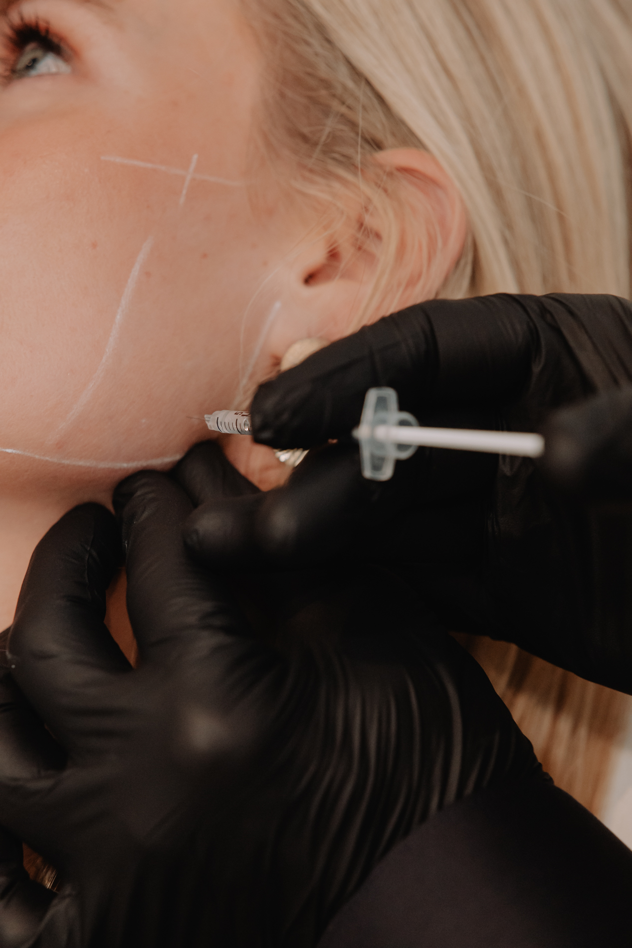 Skinject Clinic