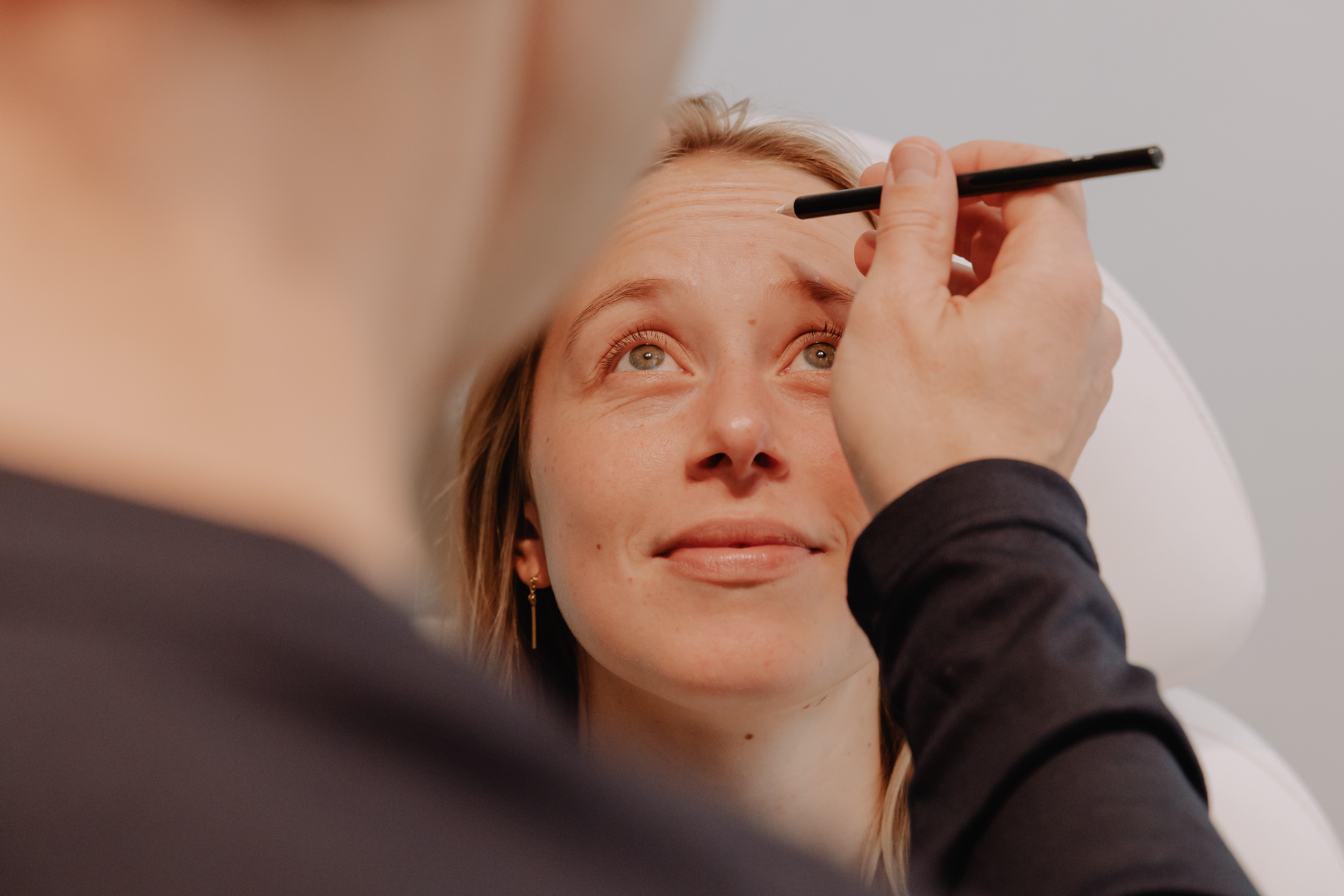 Behandeling voorhoofdrimpels met botox bij Skinject Clinic in Waasmunster