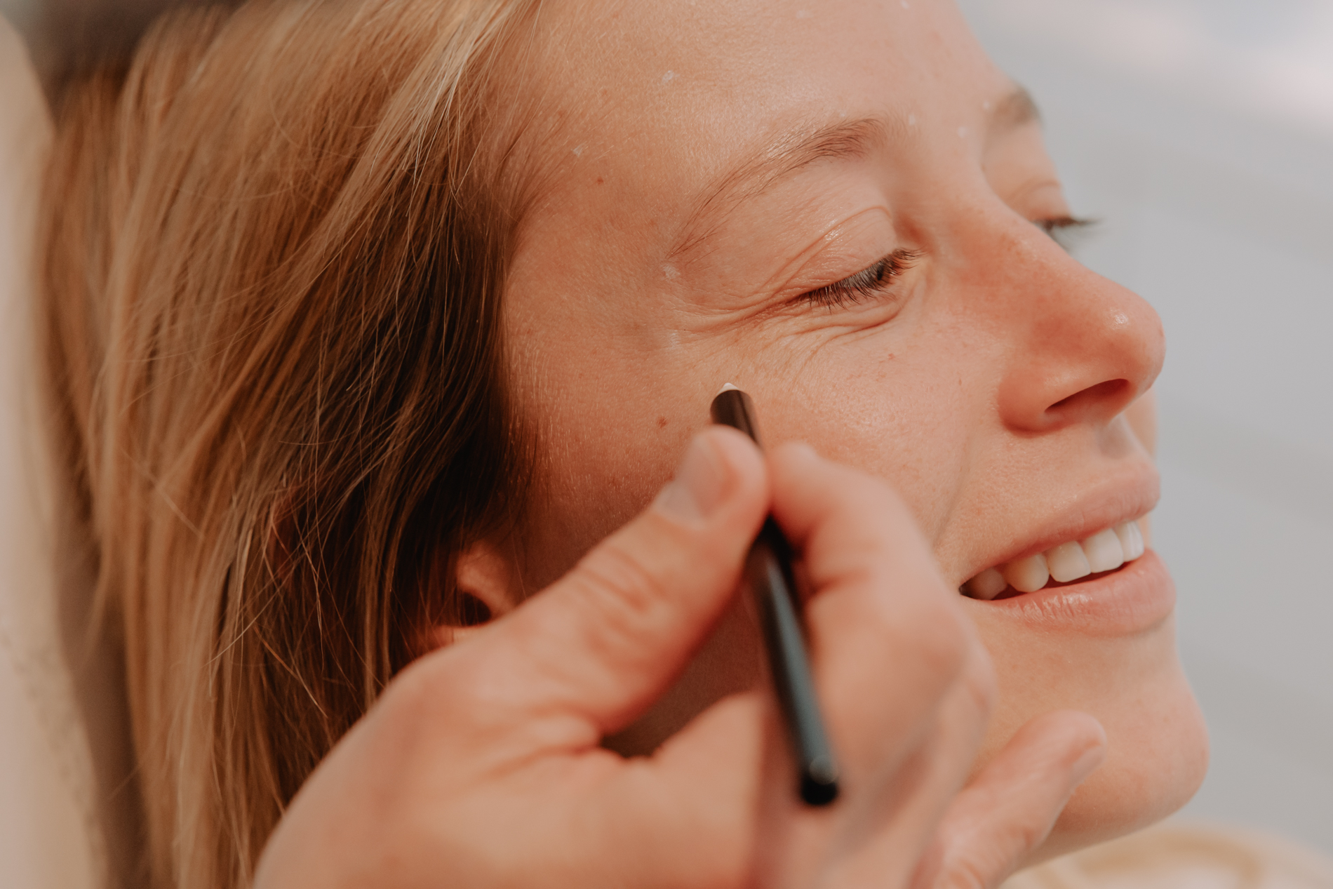 Fijne lijntjes rond de ogen (kraaienpootjes)