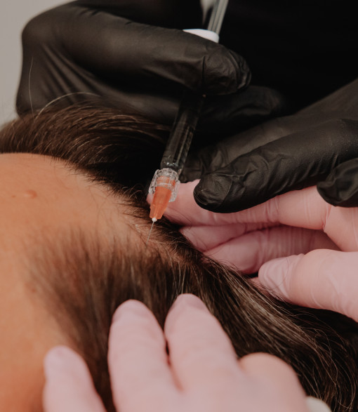 Haarverlies