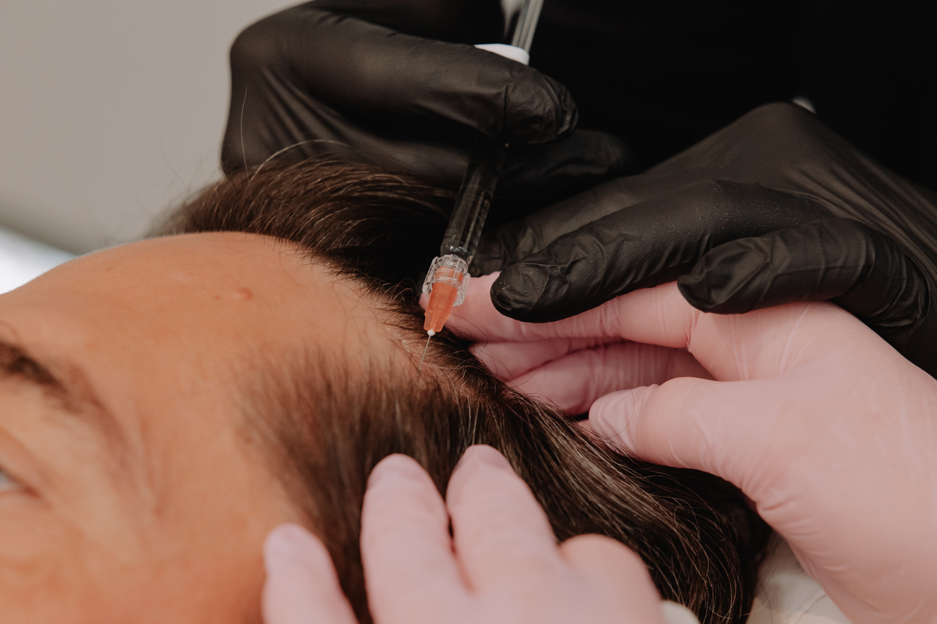 Haarverlies
