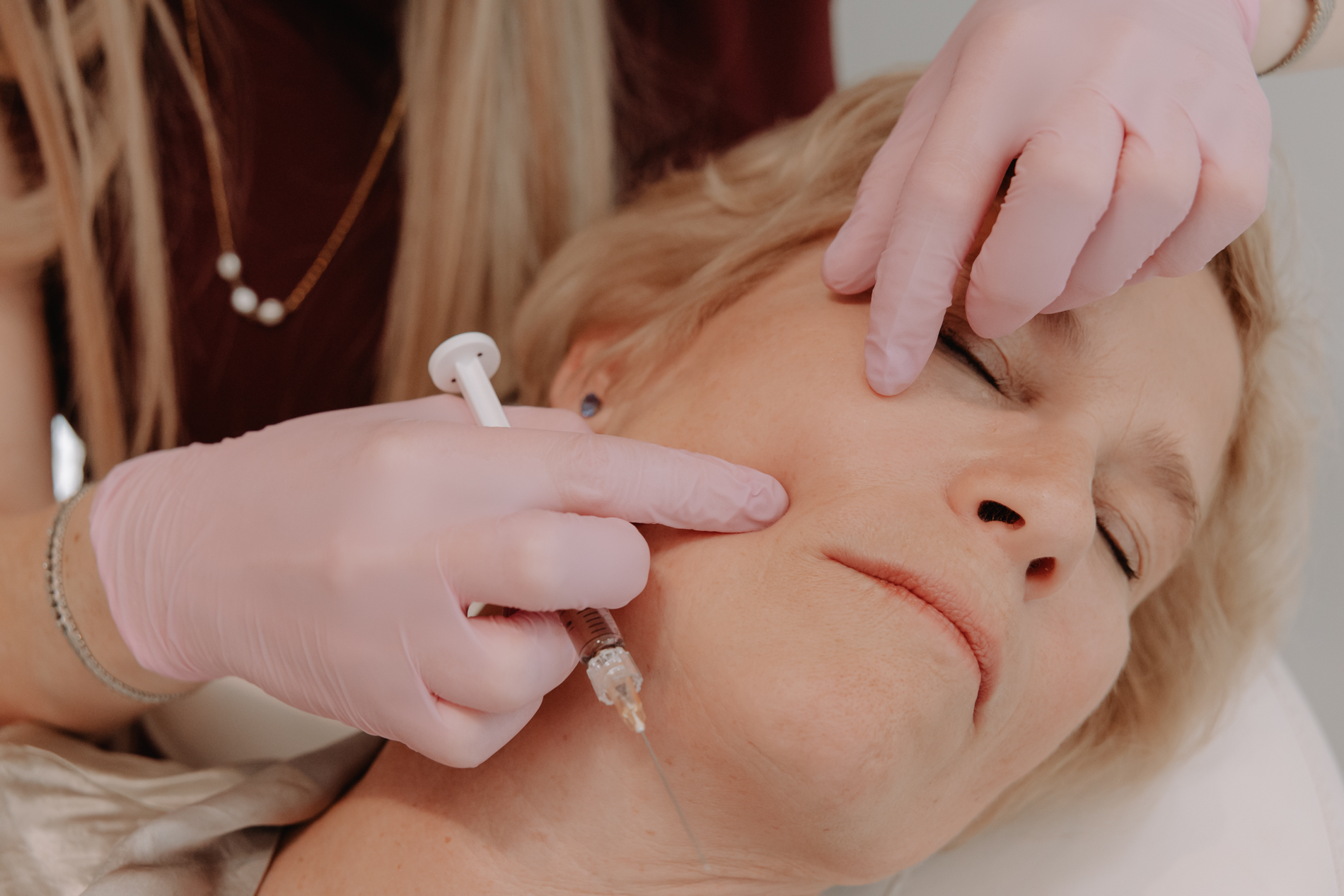 Behandeling ingevallen wangen bij Skinject Clinic in Waasmunster