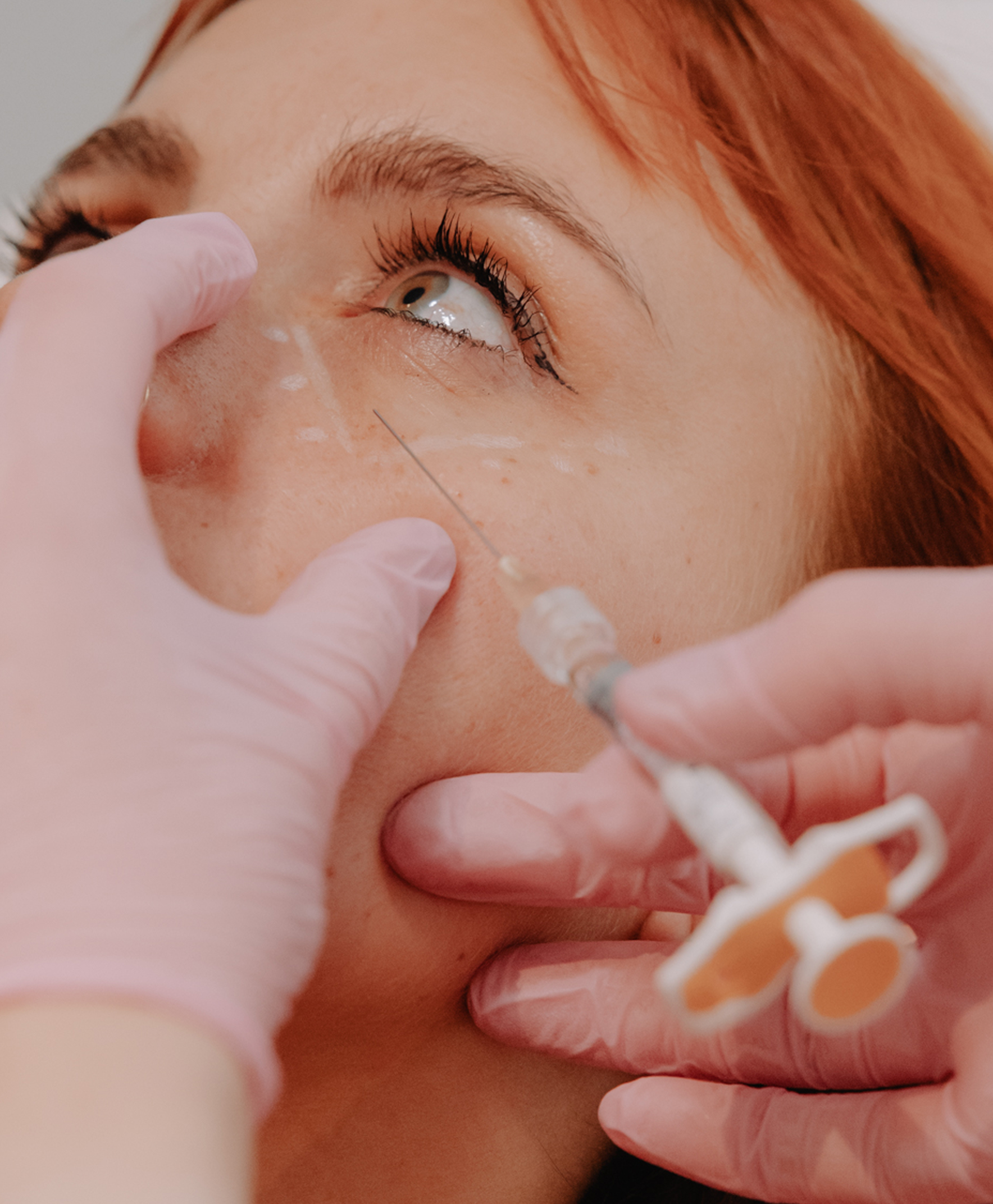 Under-eye Signature
